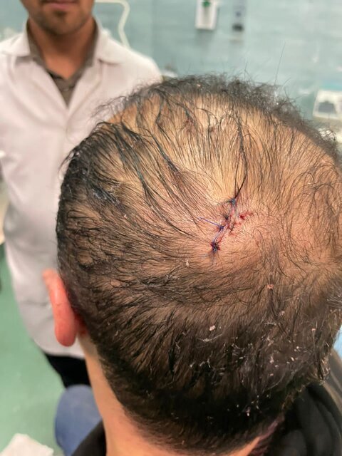 حمله به رییس هیات کشتی مازندران با چاقو در سالن مسابقات مشهد +عکس حمله به رییس هیات کشتی مازندران با چاقو در سالن مسابقات مشهد +عکس